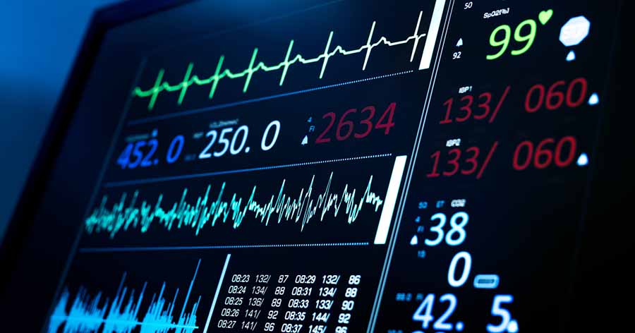 Screen of heart monitor